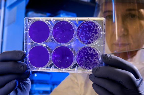 Scientist examines the result of a plaque assay.